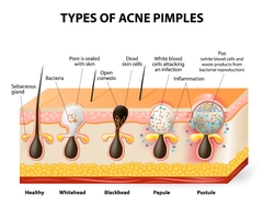 Medical Illustration Services by Mary Williams